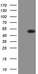 RORB Antibody in Western Blot (WB)