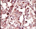 ROS1 Antibody in Immunohistochemistry (IHC)