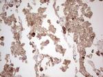 ROS1 Antibody in Immunohistochemistry (Paraffin) (IHC (P))