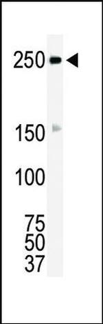 ROS1 Antibody in Western Blot (WB)