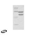 HIV1 Reverse Transcriptase Protein in Western blot control (WB Ctrl)