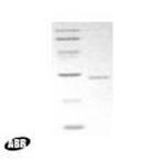 HIV1 nef Protein in Western blot control (WB Ctrl)