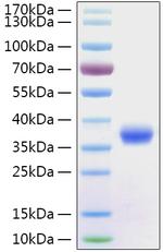 SARS-CoV-2 Spike Protein (RBD) (aa319-541), His Tag Protein
