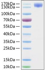 SARS-CoV-2 Spike Protein S1 (aa11-682), hFc-His Tag Protein