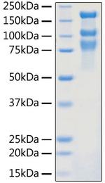 SARS-CoV-2 Spike Protein S1/S2 (aa11-1208), His Tag Protein