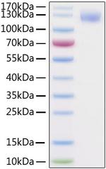 SARS-CoV-2 Spike Protein S1 (aa14-683), His-Avi Tag Protein
