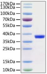 SARS-COV-2 3CL Protease (aa1-306), His and Avi Tag Protein