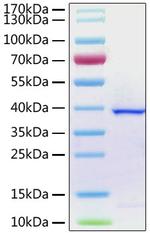 SARS-COV-2 ORF1a Polyprotein (aa1564-1878), His Tag Protein