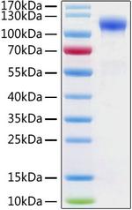 Human ACE2 (aa18-740), His-tag Protein