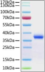 SARS-CoV-2 Spike Protein (RBD) (aa319-541), His Tag Protein