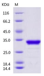 Aequorea victoria GFP His-tag Protein