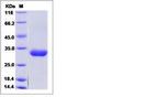 Human BTN3A2 His-tag Protein