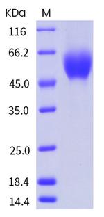 Human CD155 (PVR) His-tag Protein