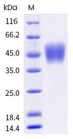 Human Fc gamma RIIIA (CD16a) (176 Phe) His-tag Protein