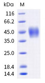 Human Fc gamma RIIIA (CD16a) (176 Val) His-tag Protein