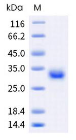 Human CD40 (TNFRSF5) His-tag Protein