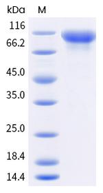 Human EGFR His-tag Protein