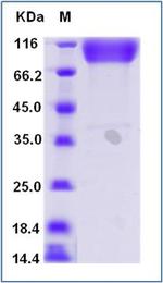 Human ICAM-1 (CD54) Fc Chimera Protein
