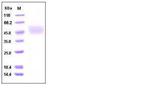 Human Kallikrein 1 His-tag Protein