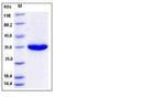Human Kallikrein 3 His-tag Protein