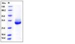 Human Kallikrein 4 His-tag Protein