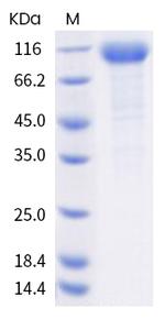 Human LILRA1 (CD85i, LIR-6) Fc Chimera Protein