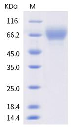 Human LILRA2 (CD85h, ILT1) His-tag Protein