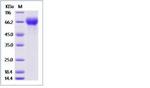 Human LILRA6 (CD85b, ILT8) His-tag Protein