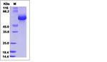 Human LILRB5 (CD85c, LIR-8) His-tag Protein