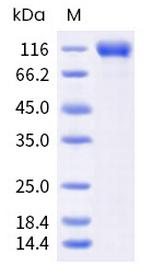 Human Siglec-2 (CD22) His-tag Protein