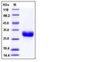Human ULBP-1 His-tag Protein