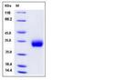 Human ULBP-2 His-tag Protein