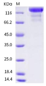 Human VEGFR3 (Flt-4) Fc Chimera Protein