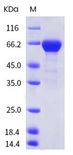 Influenza A H1N1 HA (A/California/04/2009) His-tag Protein