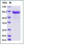 Influenza A H1N1 HA (A/California/04/2009) His-tag Protein