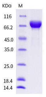 Influenza A H1N1 HA (A/California/07/2009) (mutant) His-tag Protein
