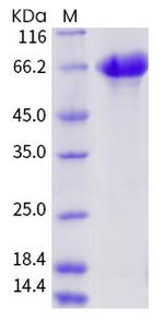 Influenza A H3N2 HA (A/Aichi/2/1968) His-tag Protein