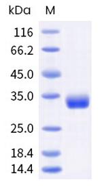 Mouse Angiopoietin-2 His-tag Protein