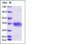Mouse ANGPTL3 (aa 1-220) His-tag Protein