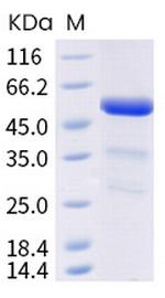 Mouse ANGPTL3 His-tag Protein