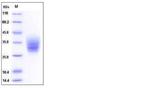 Mouse EMMPRIN (CD147) His-tag Protein
