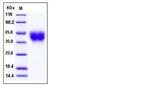 Mouse CD200 His-tag Protein