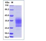 Mouse CD79b His-tag Protein