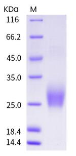 Mouse CTLA-4 His-tag Protein