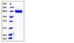 Mouse EphA4 His-tag Protein