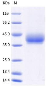 Mouse LILRB4 (CD85k, ILT3) His-tag Protein