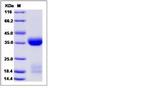 Mouse Kallikrein 1 His-tag Protein
