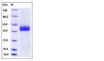 Mouse Kallikrein 11 His-tag Protein