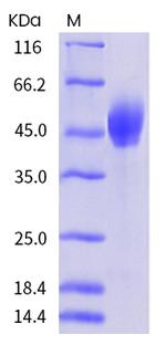 Mouse PD-L1 (B7-H1) His-tag Protein