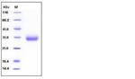 Mouse VSIG4 His-tag Protein